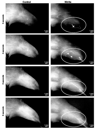 A collage of x-ray images of a human foot

AI-generated content may be incorrect.