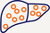 02_MDGL_FDA_forMASH_Liver.jpg
