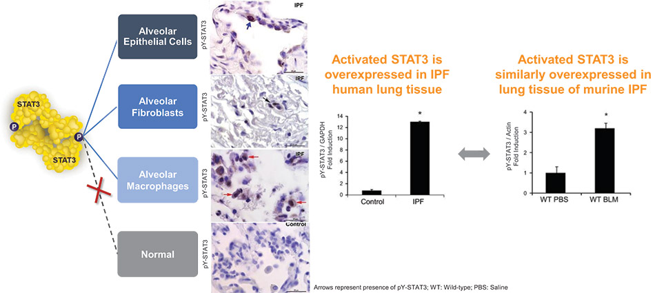 [MISSING IMAGE: ph_majorcompartments-4clr.jpg]