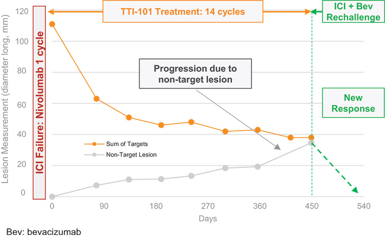 [MISSING IMAGE: ph_tumortrajectories-4c.jpg]