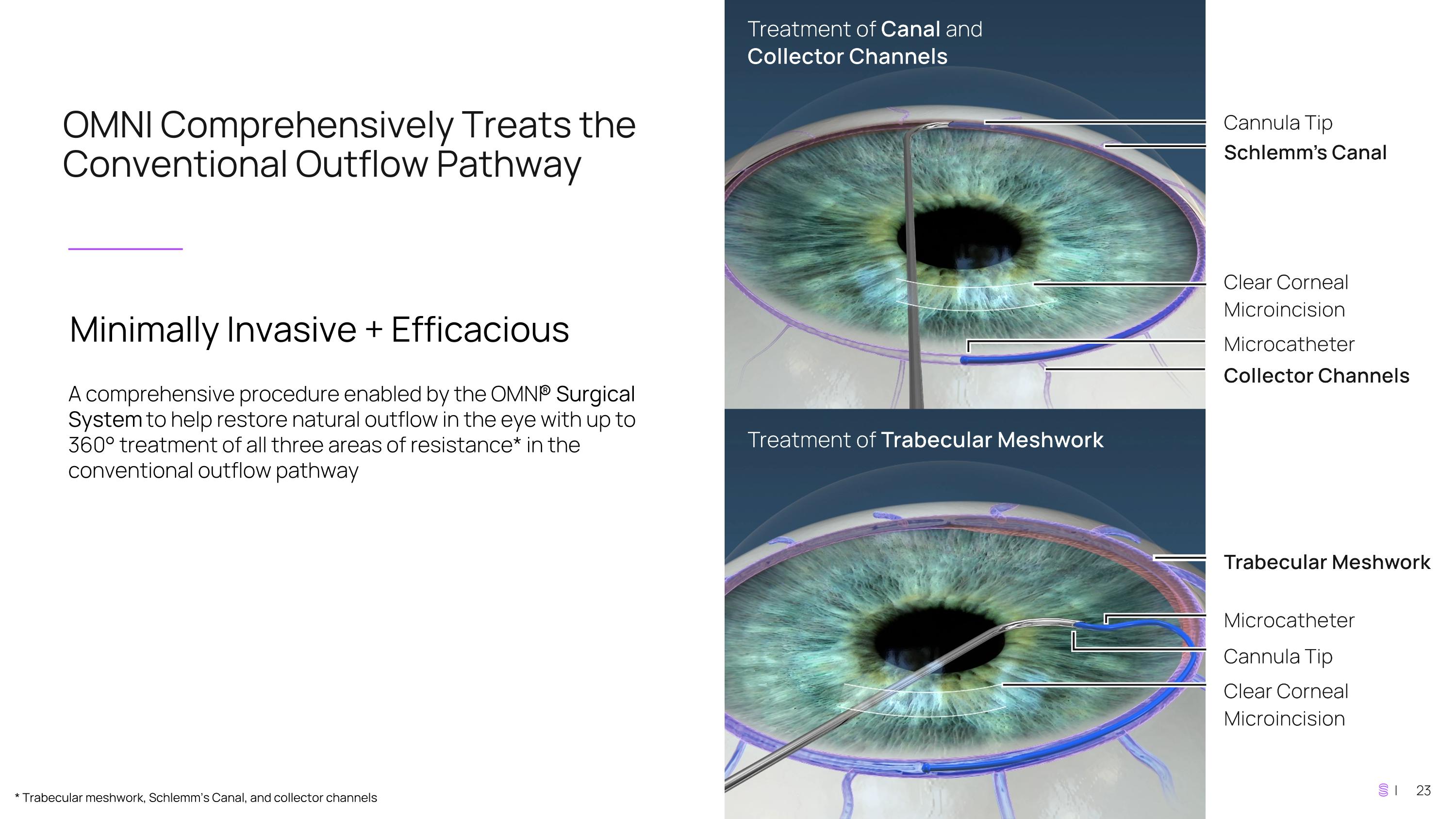 Slide 23