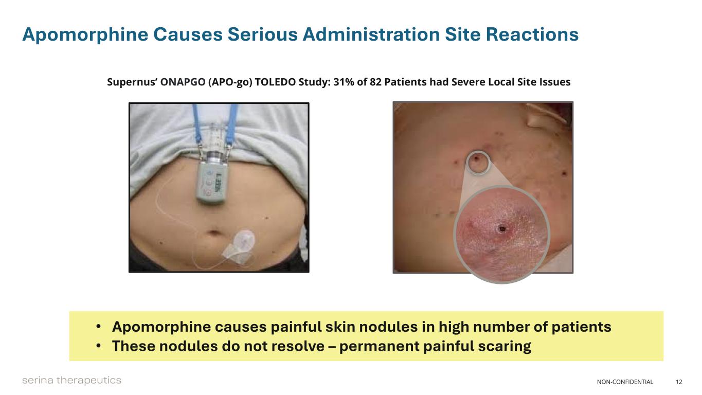 slide12