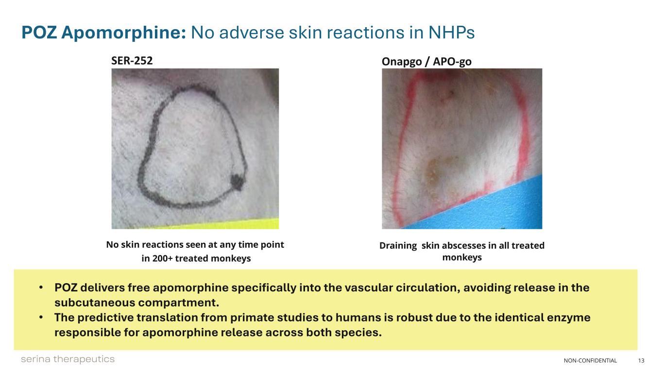 slide13