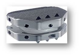 A close-up of a metal object
Description automatically generated